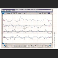 EEG-Design.jpg